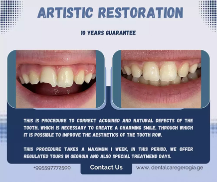 Slider image (2) Universe Dental - Best Dental Clinic in Tbilisi, Georgia